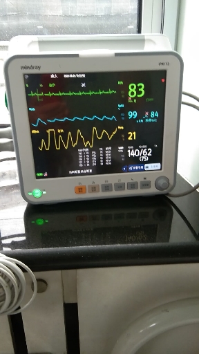 心电监护不显示心电图图片
