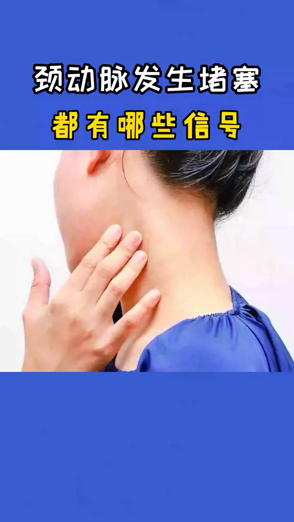 颈动脉发生堵塞都有哪些信号