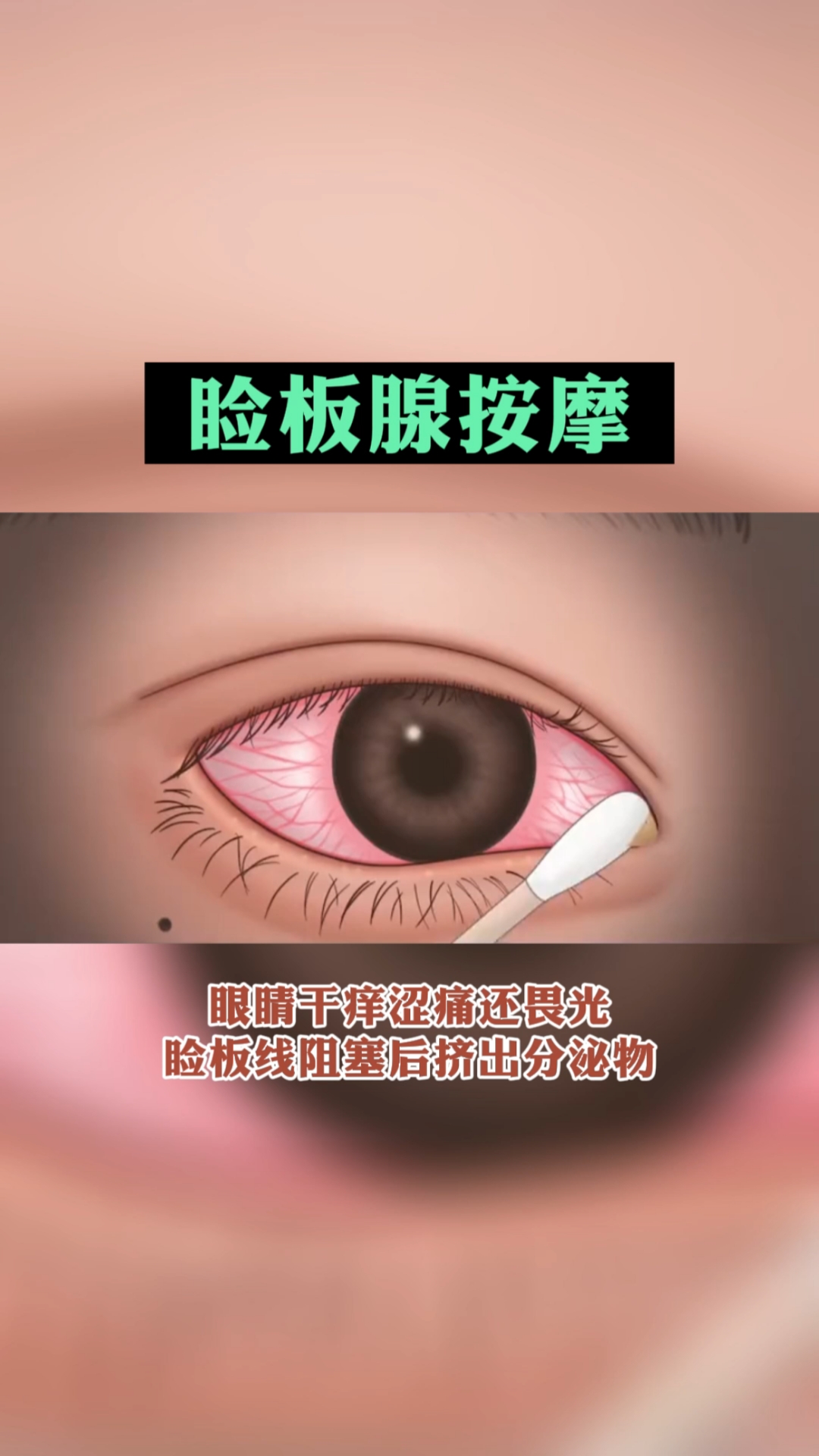 好看的眼睛#瞼板腺也是需要按摩的,你知道嗎?