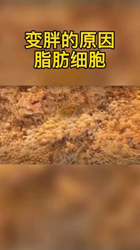 原来我不是胖只是我的脂肪细胞比较强壮