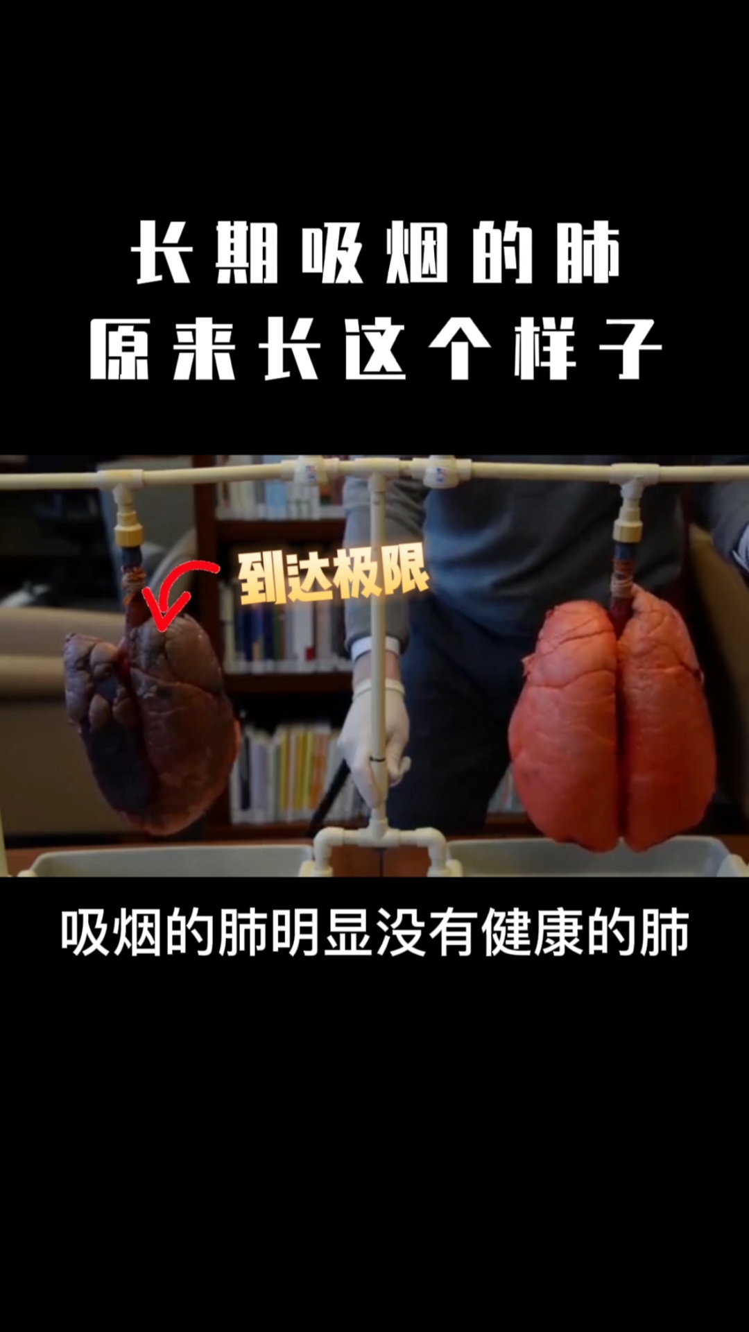 吸烟有害健康尽早戒烟来看看这是不是你的肺很直观的对比了