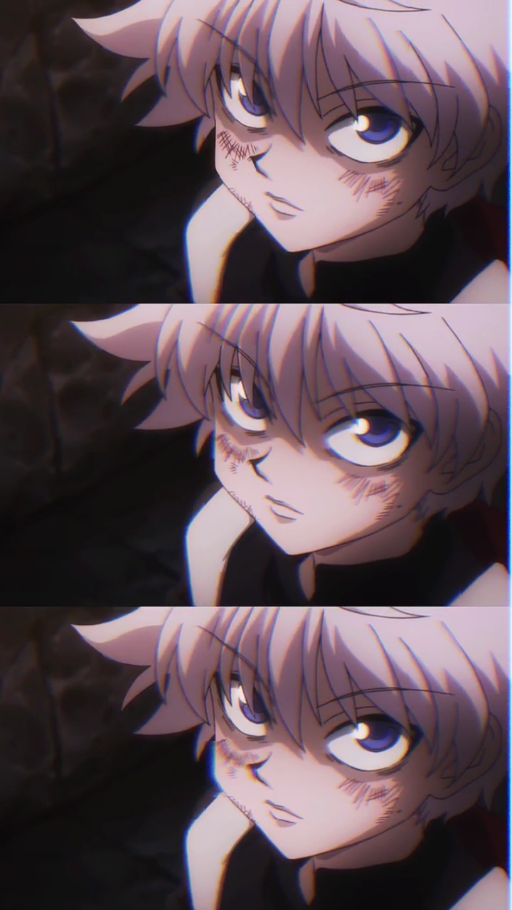 全职猎人#动漫奇犽和妈妈的对抗