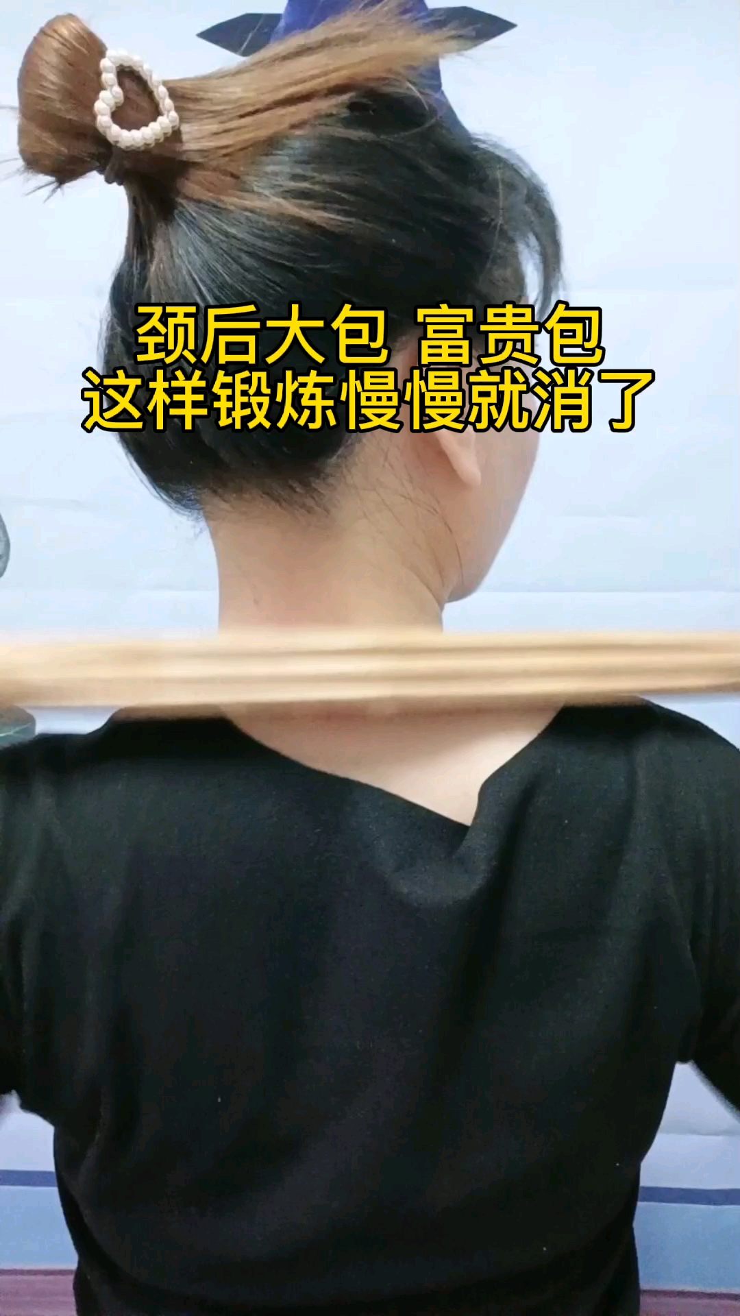 健康养生小知识颈后大包富贵包经常这样锻炼