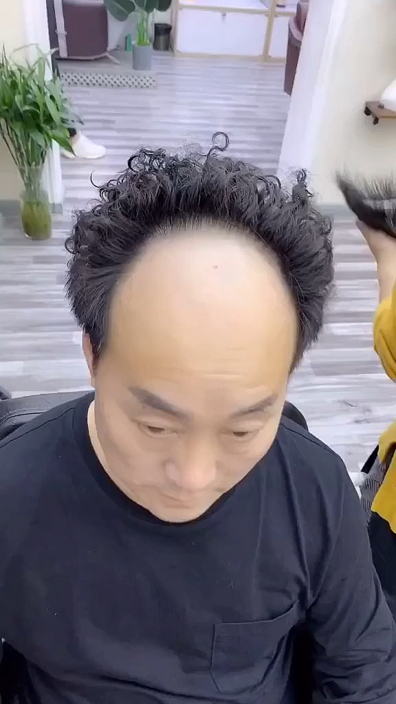 发际线高的男人有福了