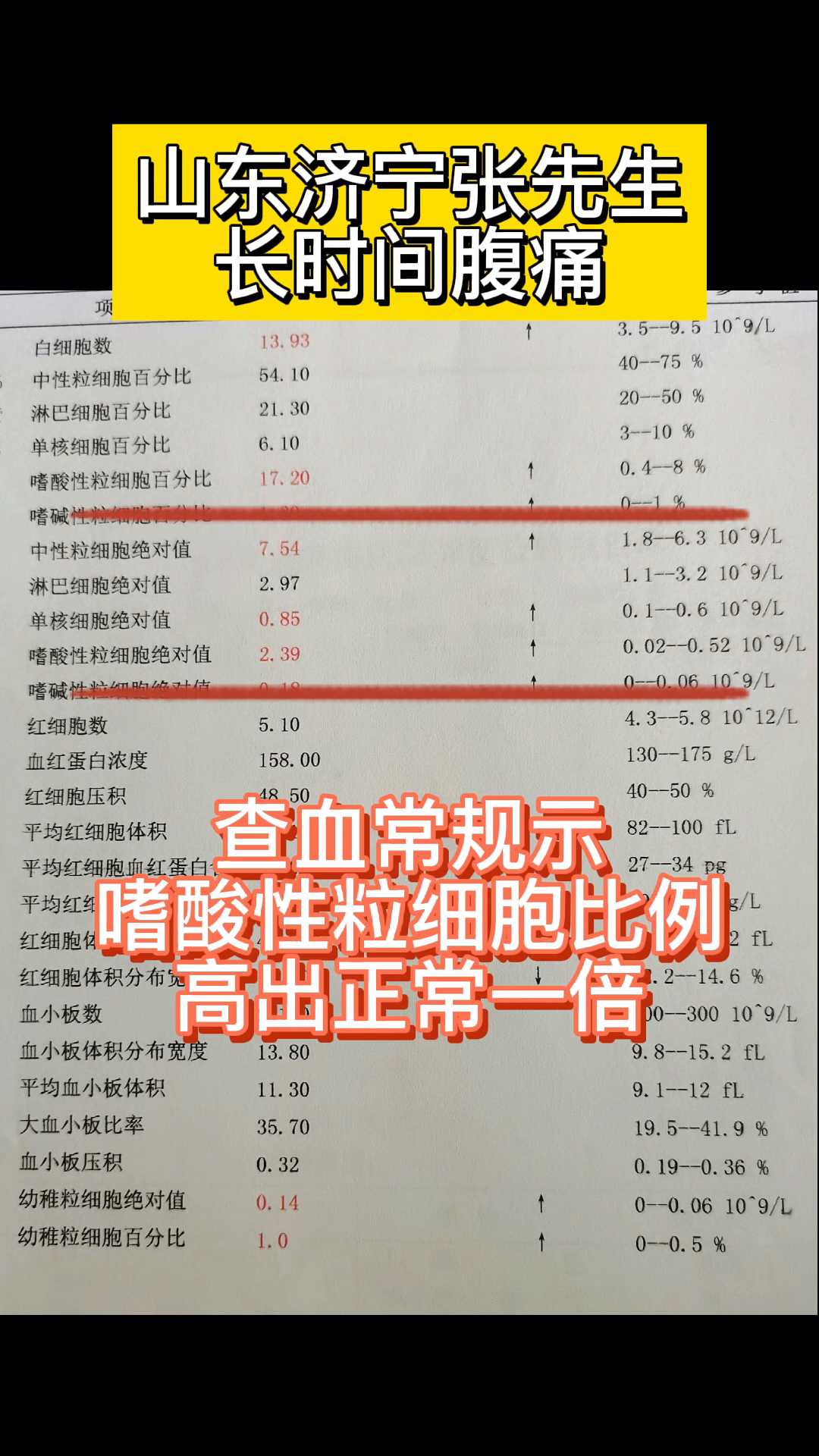 张先生长时间腹痛结果出来嗜酸性粒细胞比例高出正常值一倍之多
