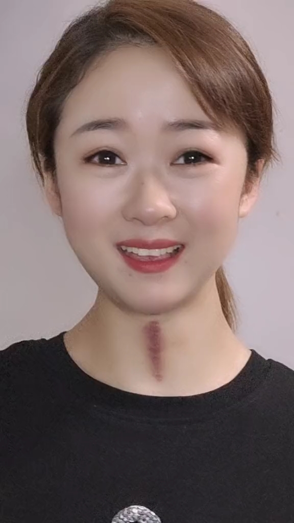 全民正能量#欢迎合拍!脖子上是中暑留下的痕迹