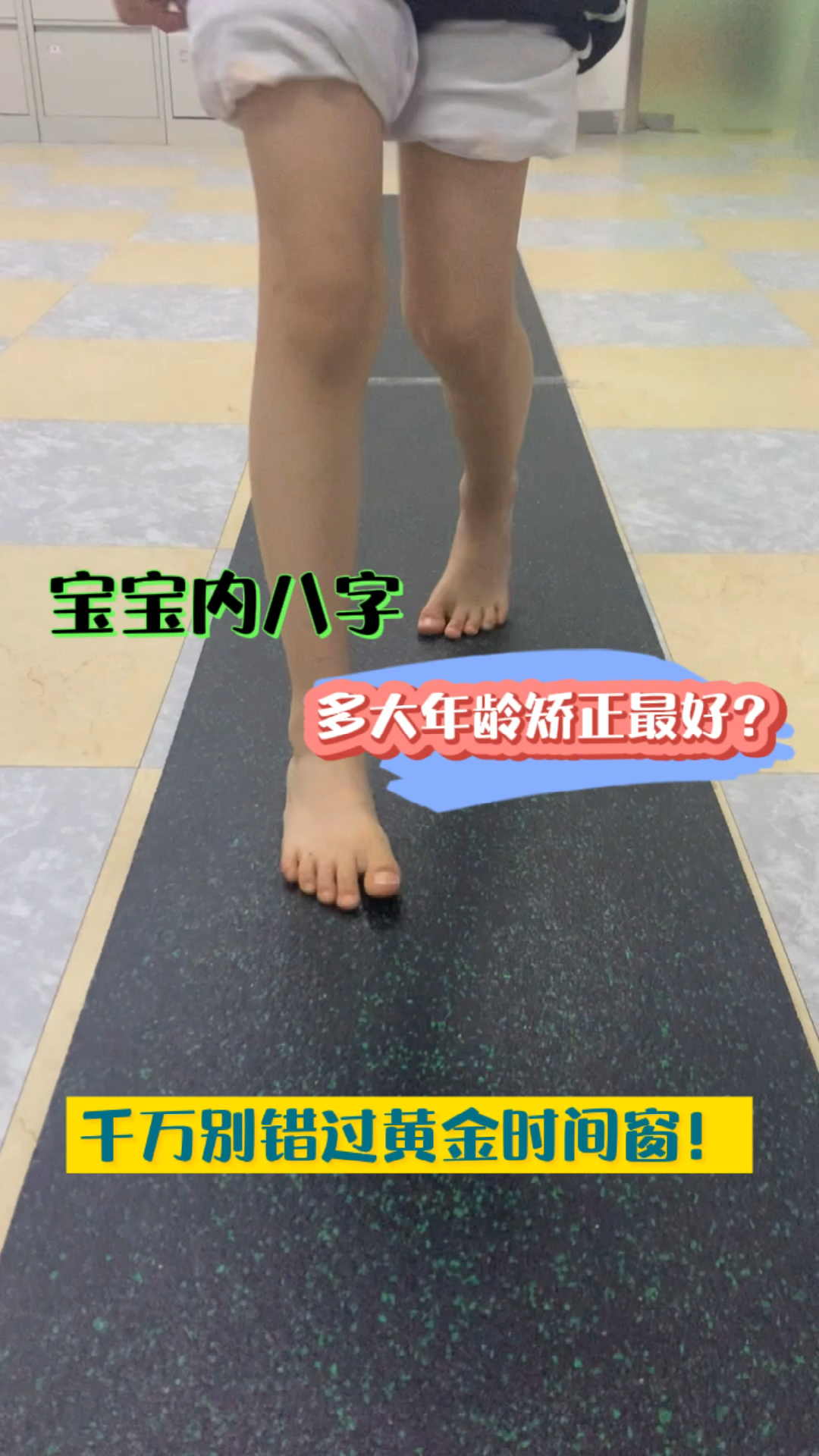 育儿宝宝走路内八字是什么样子多大年龄矫正最好骨科医生建议千万别