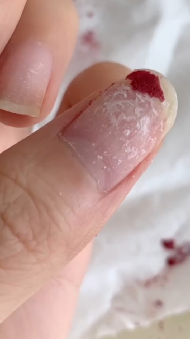 美甲#有强迫症的姐妹们,抠完指甲是不是这样!抠完指甲超薄!