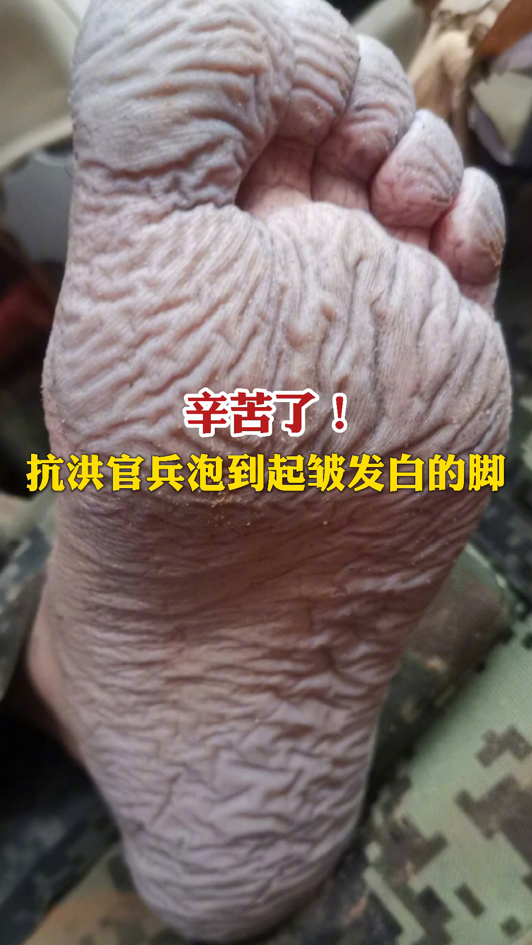 辛苦了抗洪官兵泡到起皱发白的脚