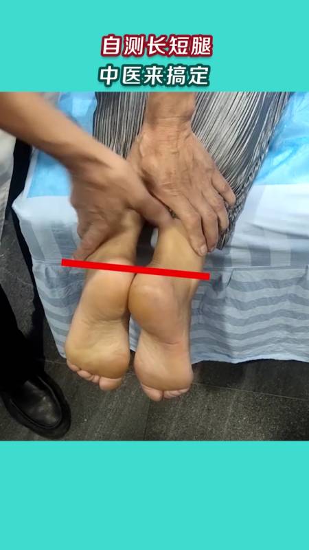 中医正骨#自测长短腿,中医帮你搞定长短腿