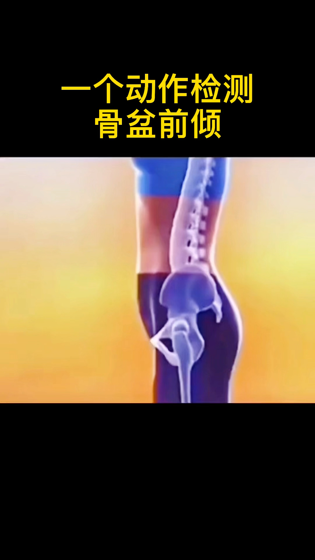 骨盆前倾不是所有的小肚子突出伴随着腰痛都是骨盆前倾今天一个动作帮