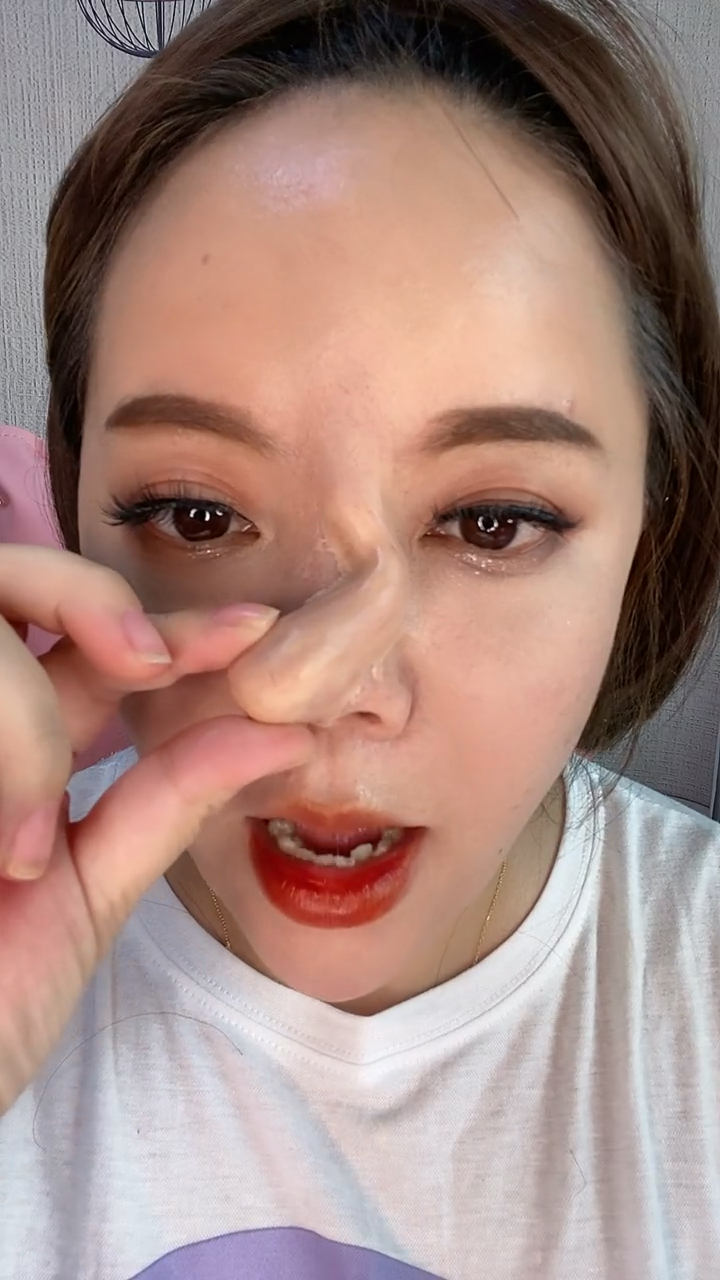 几w做的鼻子歪了真闹心