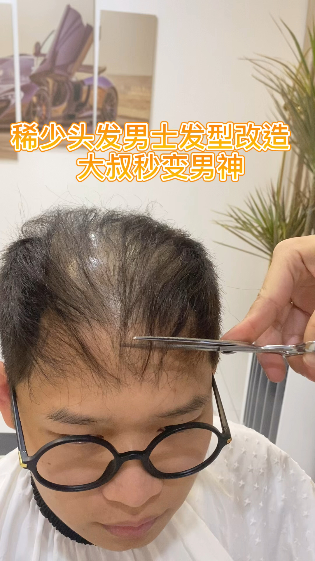 不一樣的人生#深圳稀少髮量男士髮型改造,深圳男士補發假髮