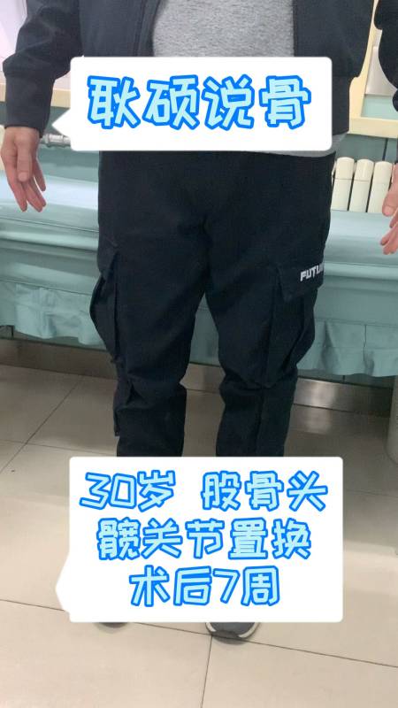 髋关节置换30岁股骨头坏死髋关节置换术后7周什么样到底什么感受