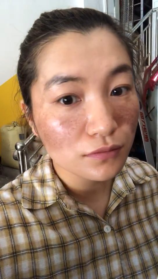 曾经满脸麻子的我被人抛弃.现在的我.非常自信.