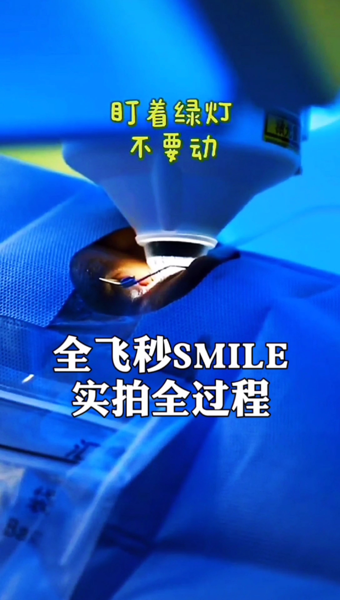 近视全飞秒近视手术全过程实拍99的朋友都没见过