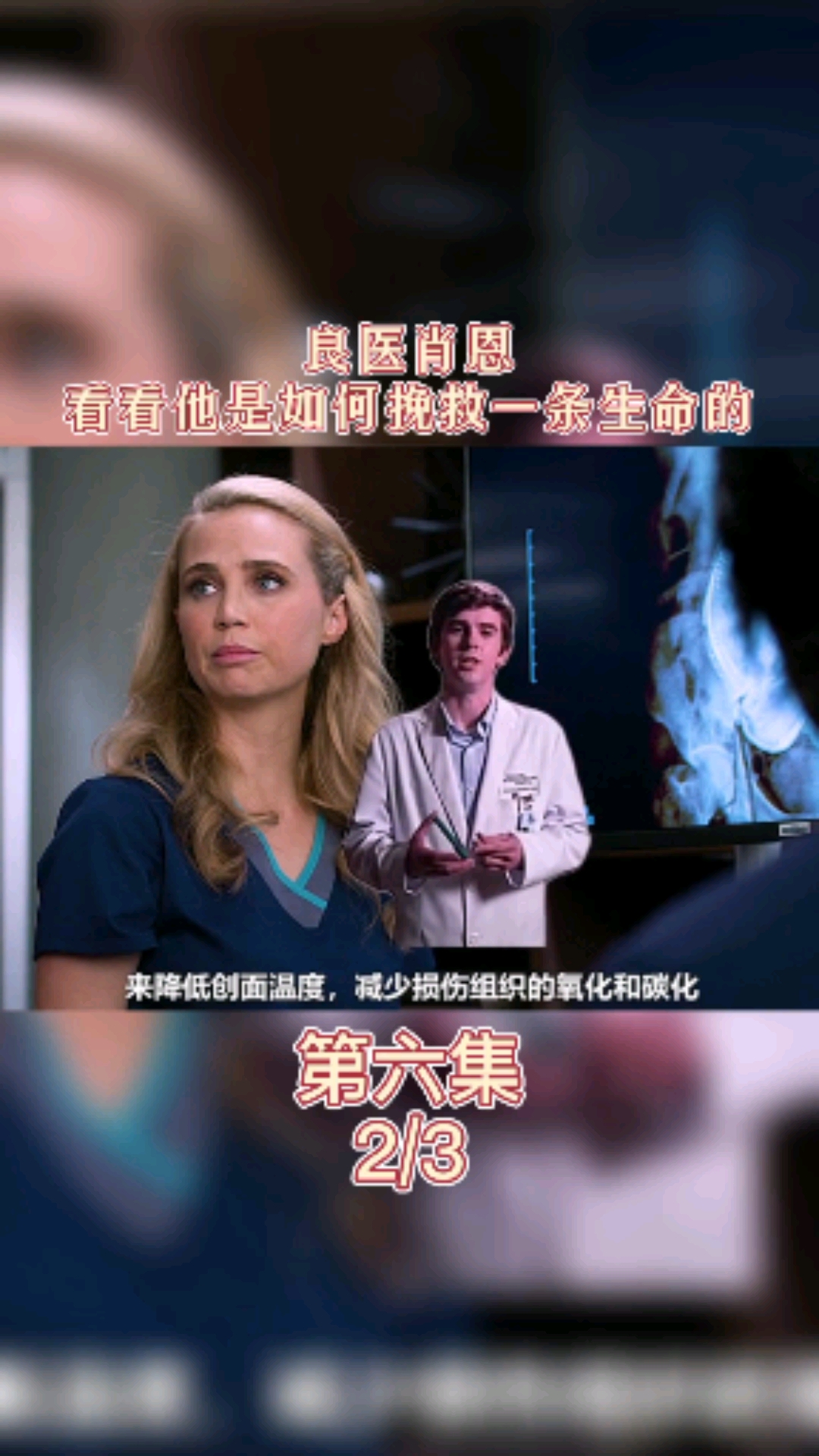 电影解说#良医肖恩,看看他是如何挽救一条生命的