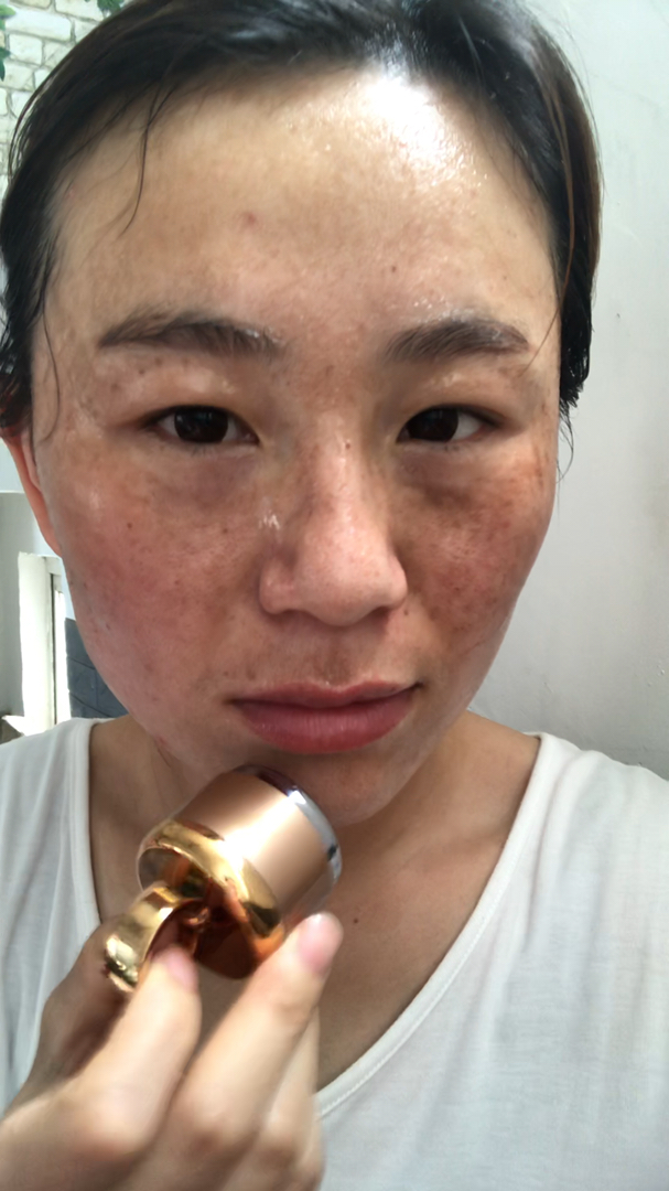 我太难了#十年婚姻,八年麻子脸,三个月的改变,只花了一件衣服的,方法