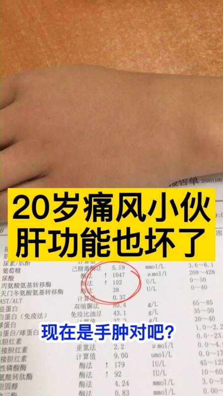 全民医生说20岁痛风小伙肝功能也坏了