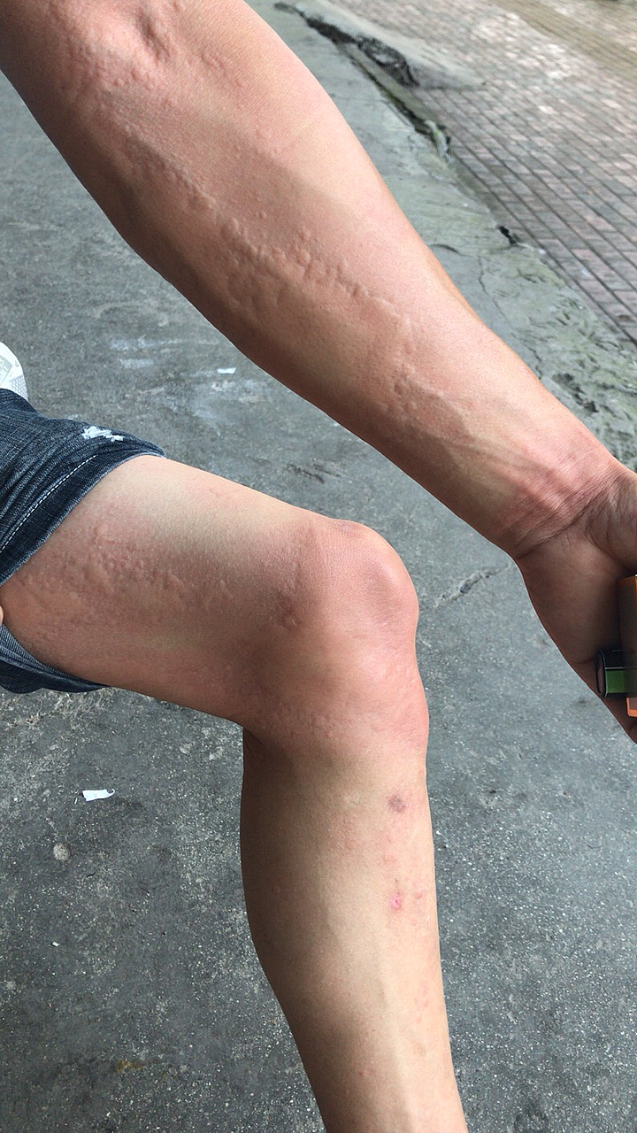 不一样的人生#昨天你骂我,我说晚上让蚊子咬死你.