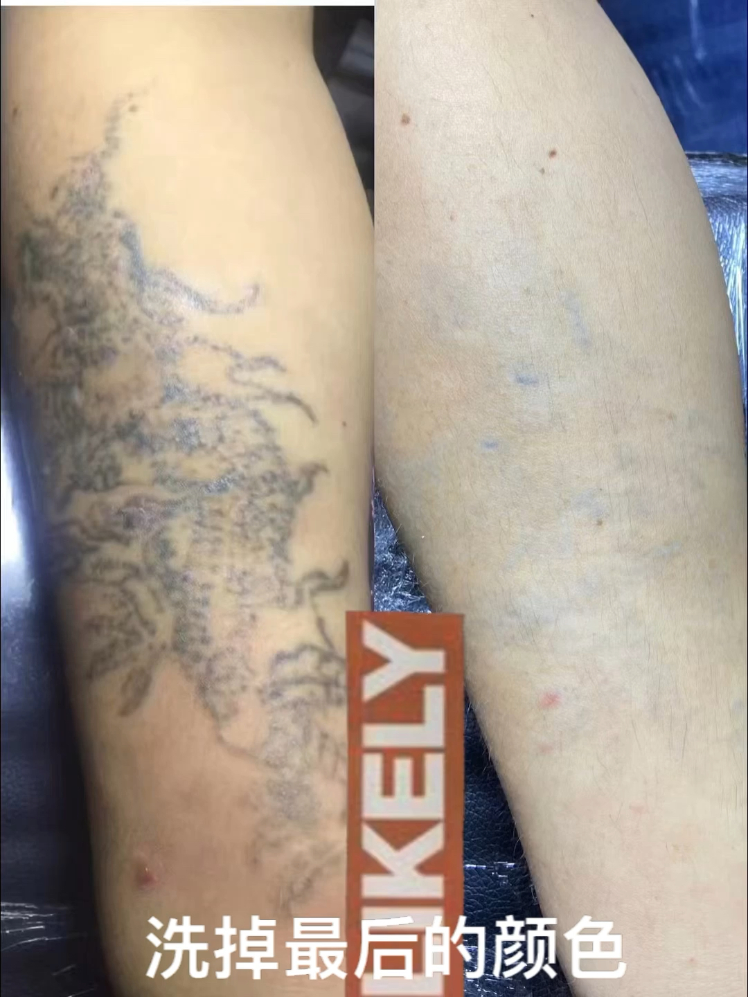 洗纹身洗掉最后的一丁点颜色