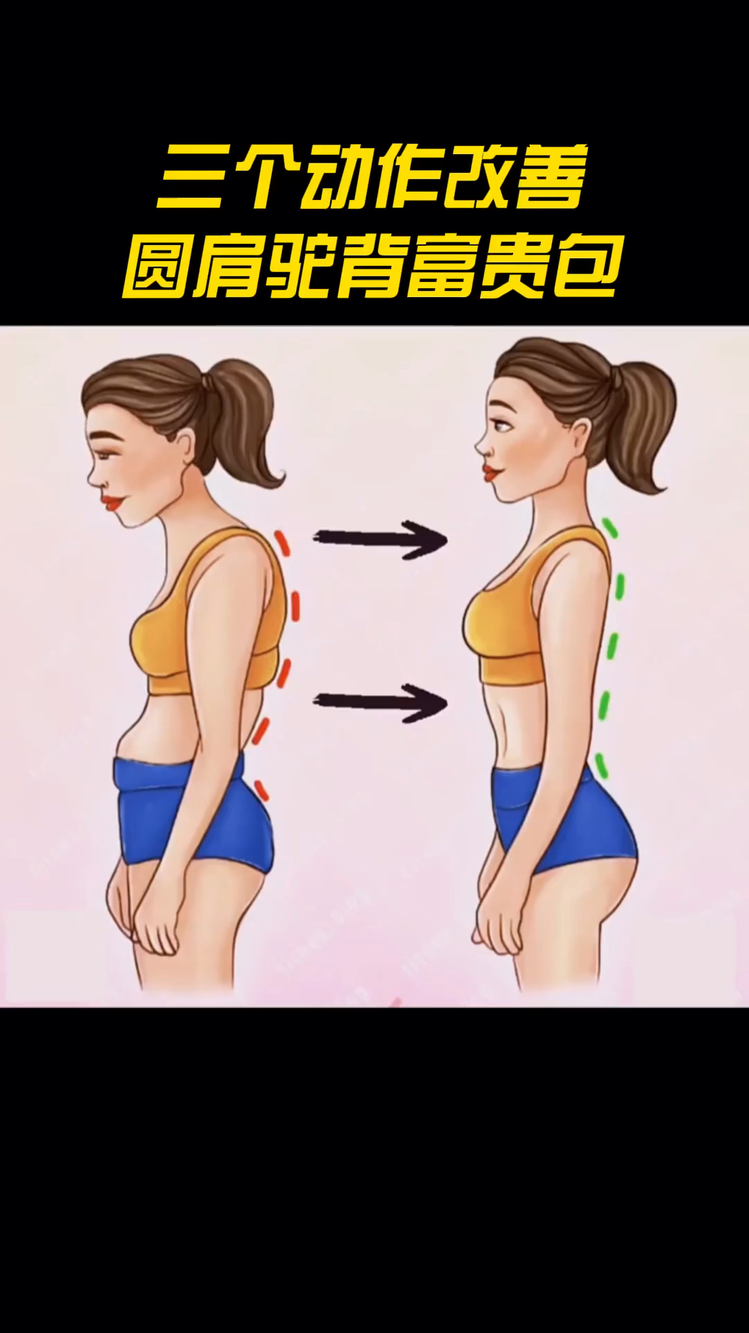 三个动作改善圆肩驼背富贵包