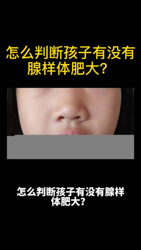 宝宝腺样体肥大妈妈需要重视,会导致腺样体面容